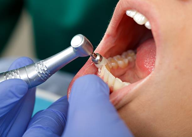 Laser Dentistry in Madeira Beach, FL